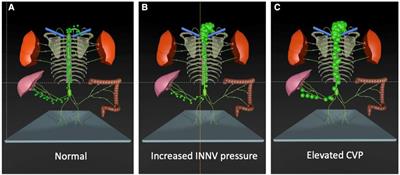 Current diagnostic and therapeutic strategies for the management of lymphatic insufficiency in patients with hypoplastic left heart syndrome